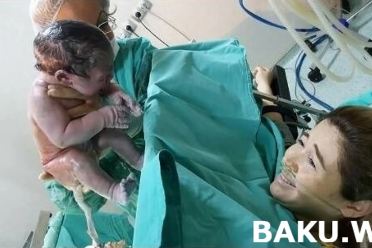 Elnarə Xəlilovanın doğuş anının fotosu yayıldı Elnarə Xəlilovanın doğuş anının fotosu yayıldı