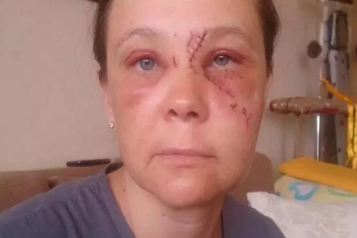 В Баку женщина разбила лицо, упав с эскалатора