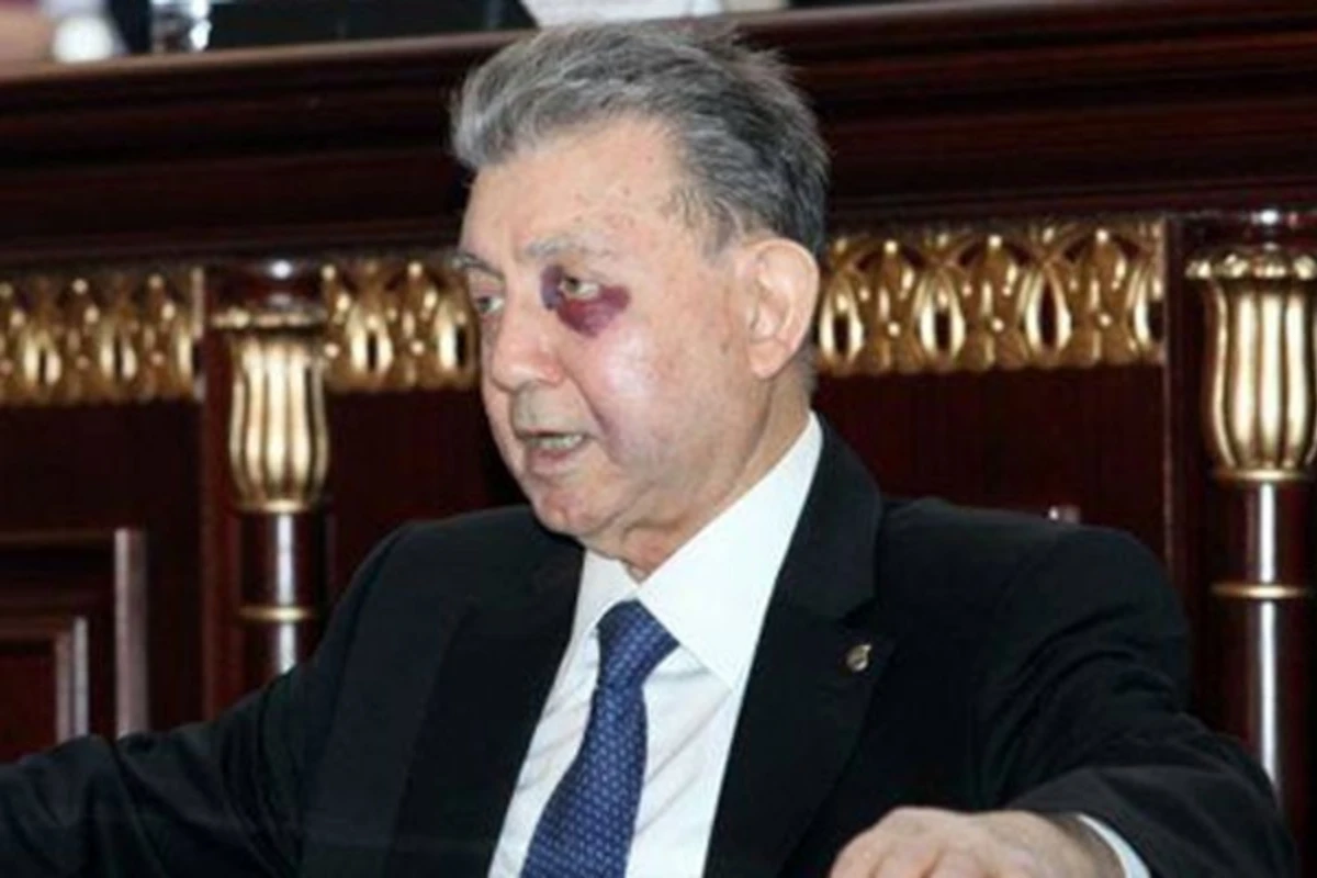 Akif Əlizadəyə nə olub? - Özü danışdı (FOTO) Akif Əlizadəyə nə olub? - Özü danışdı (FOTO)