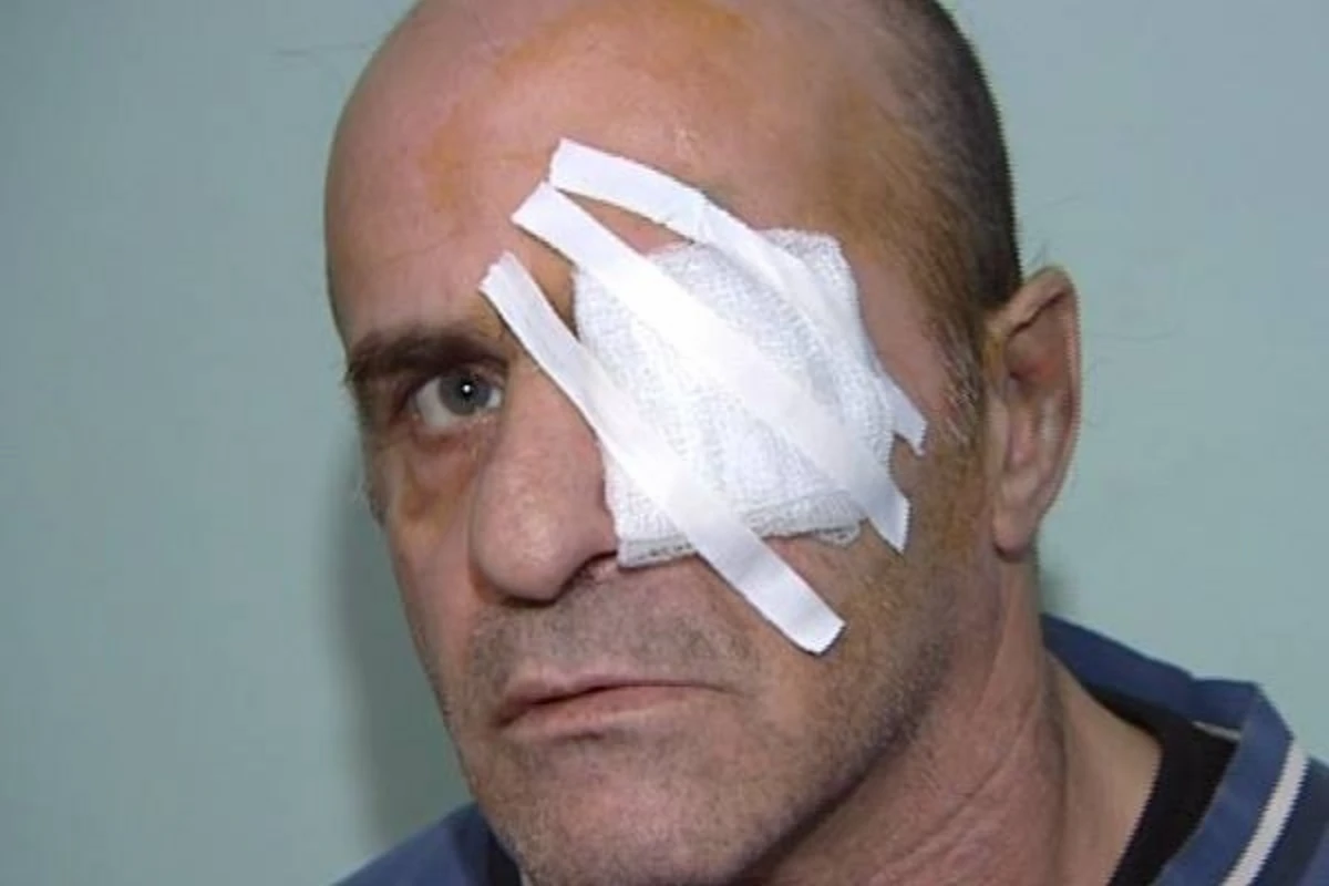Həkim Bakıda xəstənin gözünün çıxarılmasına aydınlıq gətirdi Həkim Bakıda xəstənin gözünün çıxarılmasına aydınlıq gətirdi