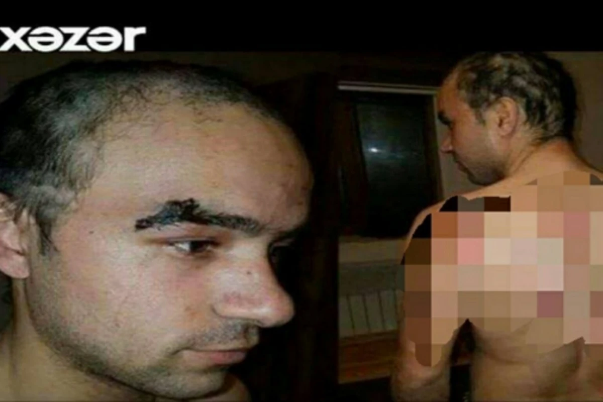 Bakıda dəhşət: ata oğlunu yun çubuğu ilə döydü, qayçı ilə saçını qırxdı (VİDEO)