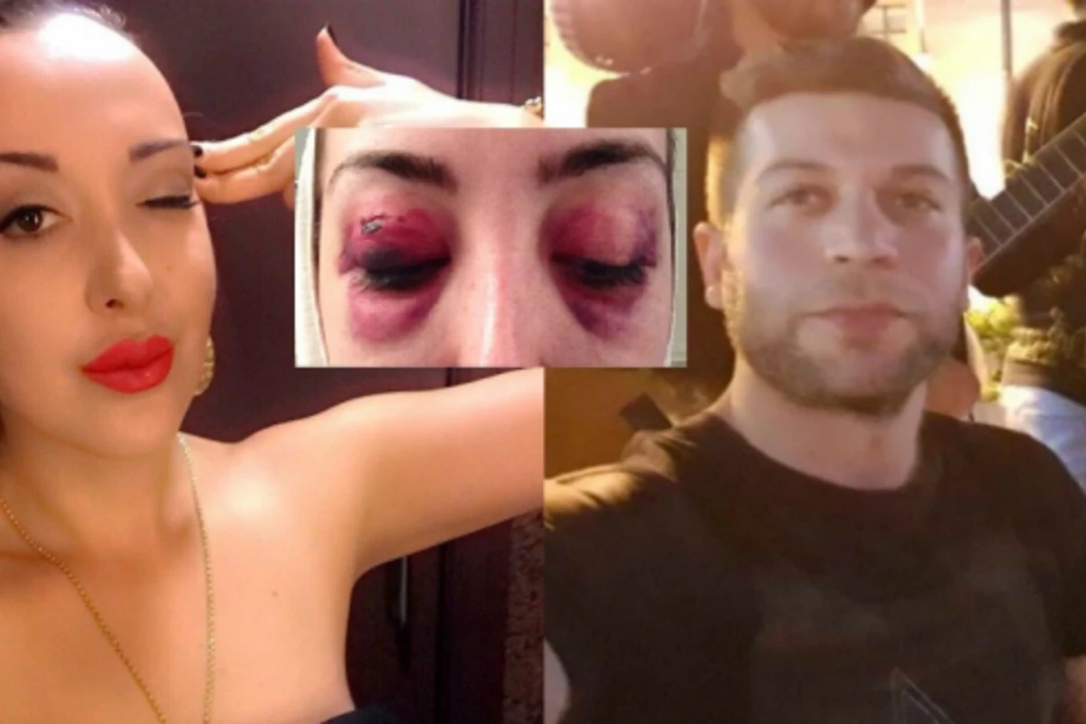 В Баку мужчина до полусмерти избил бывшую жену, не желающую с ним мириться (фото)