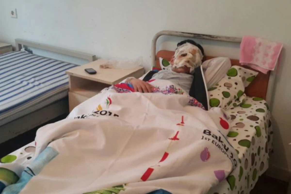 Разводивший огонь по случаю Од чершенбеси школьник получил ожоги (фото)