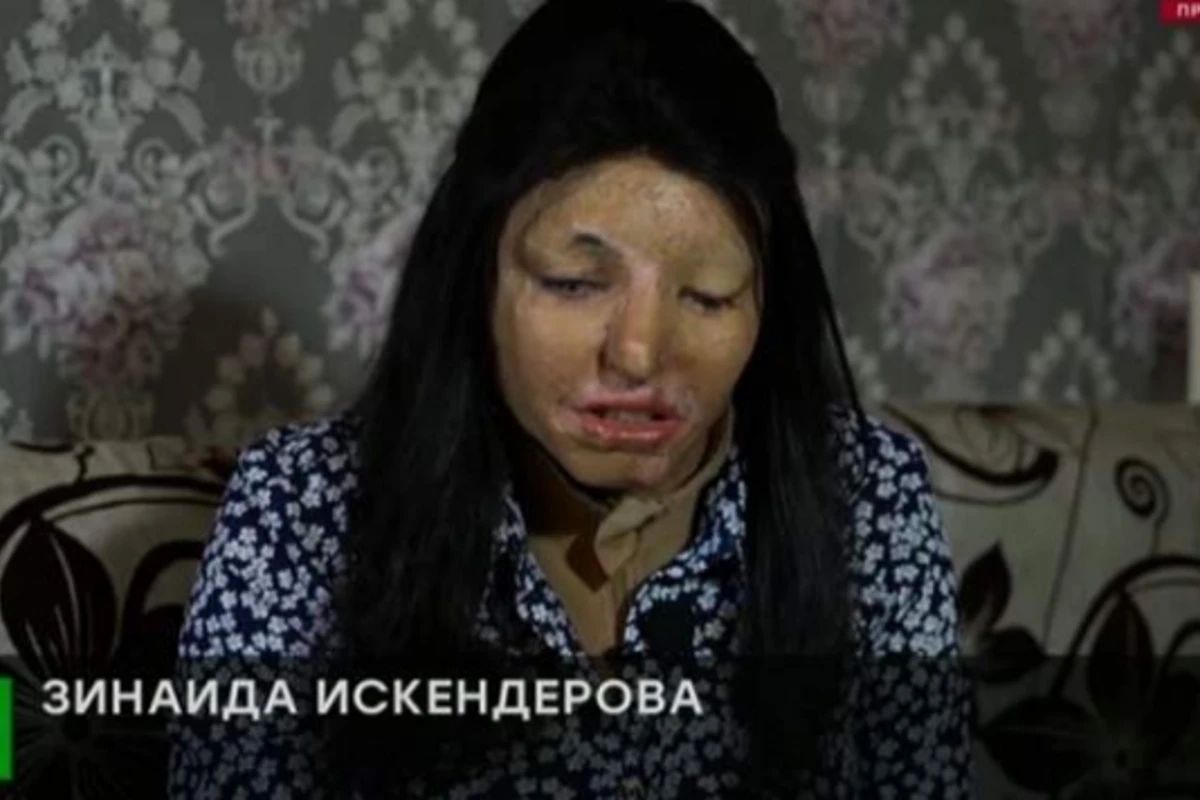 Россиянка из мести облила подругу кислотой и сбежала в Азербайджан (видео)