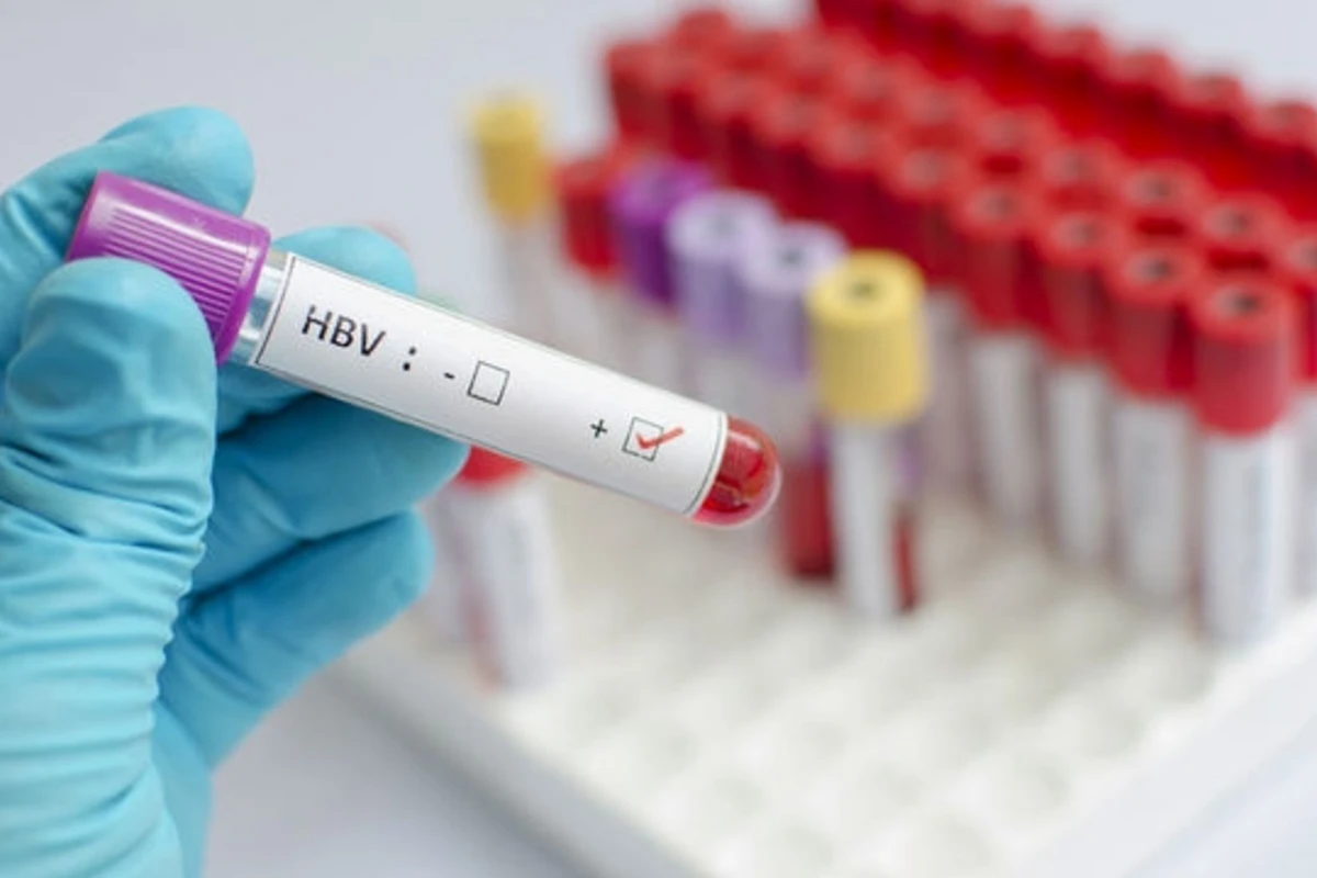 Hepatit ola biləcəyinizi göstərən 5 əlamət - Əgər 3-ü sizdə varsa... Hepatit ola biləcəyinizi göstərən 5 əlamət - Əgər 3-ü sizdə varsa...