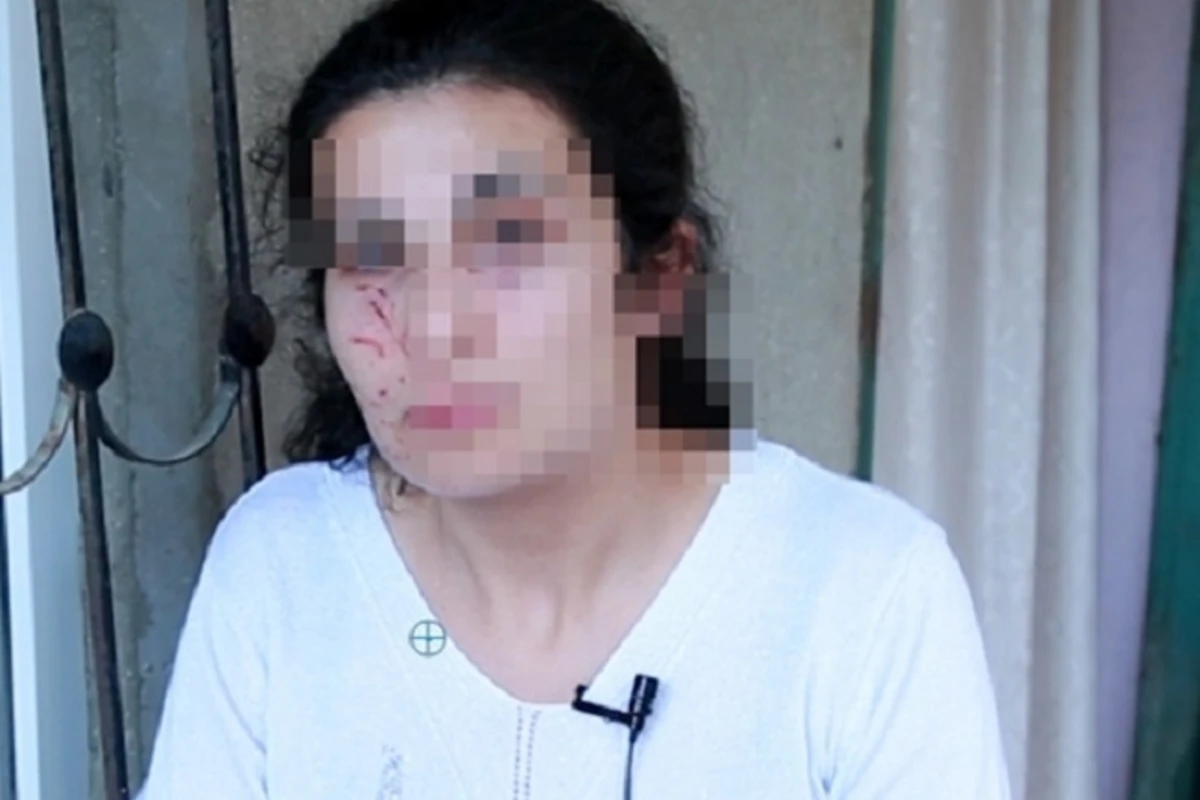 Bakıda zorlanmadan son anda qurtarılan qadın: “Məni yerə yıxıb, üstümdə oturdu” – VİDEO