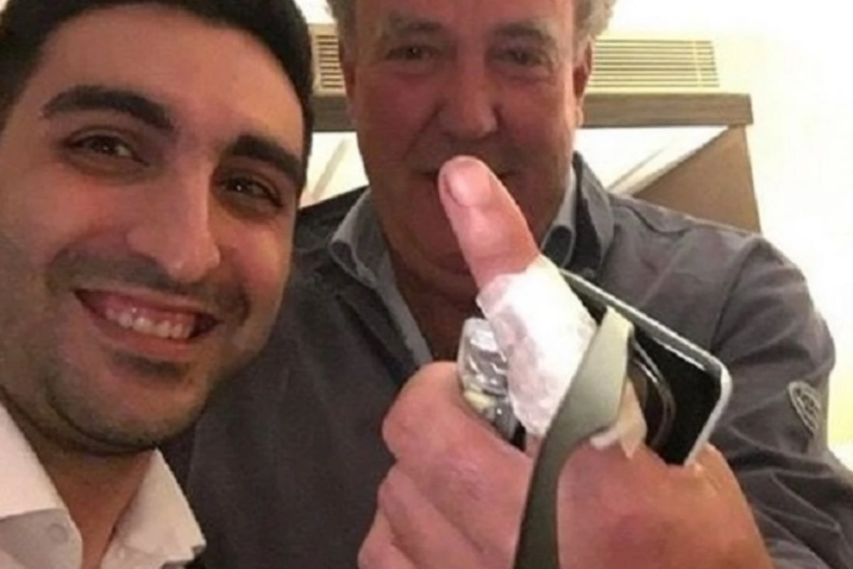 Jeremi Klarksonun Azərbaycanda barmağını tikdilər