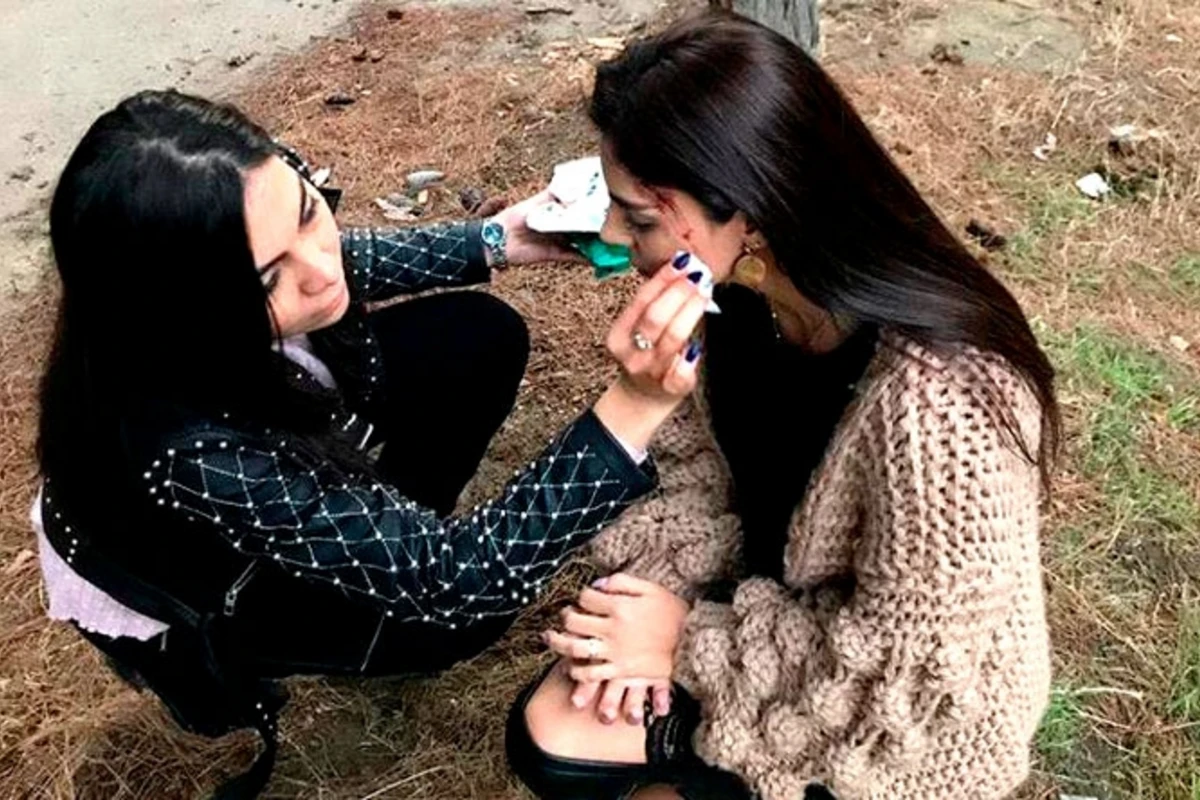 Natavanın çəkilişdə başı yarıldı - FOTO