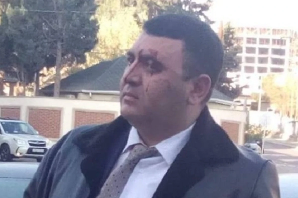 Döyülən direktorun atası: Oğlumun vəziyyəti ağırdır