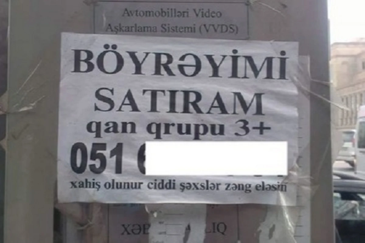 Bakıda vətəndaş orqanlarını satışa çıxardı - icazə var? - VİDEO Bakıda vətəndaş orqanlarını satışa çıxardı - icazə var? - VİDEO