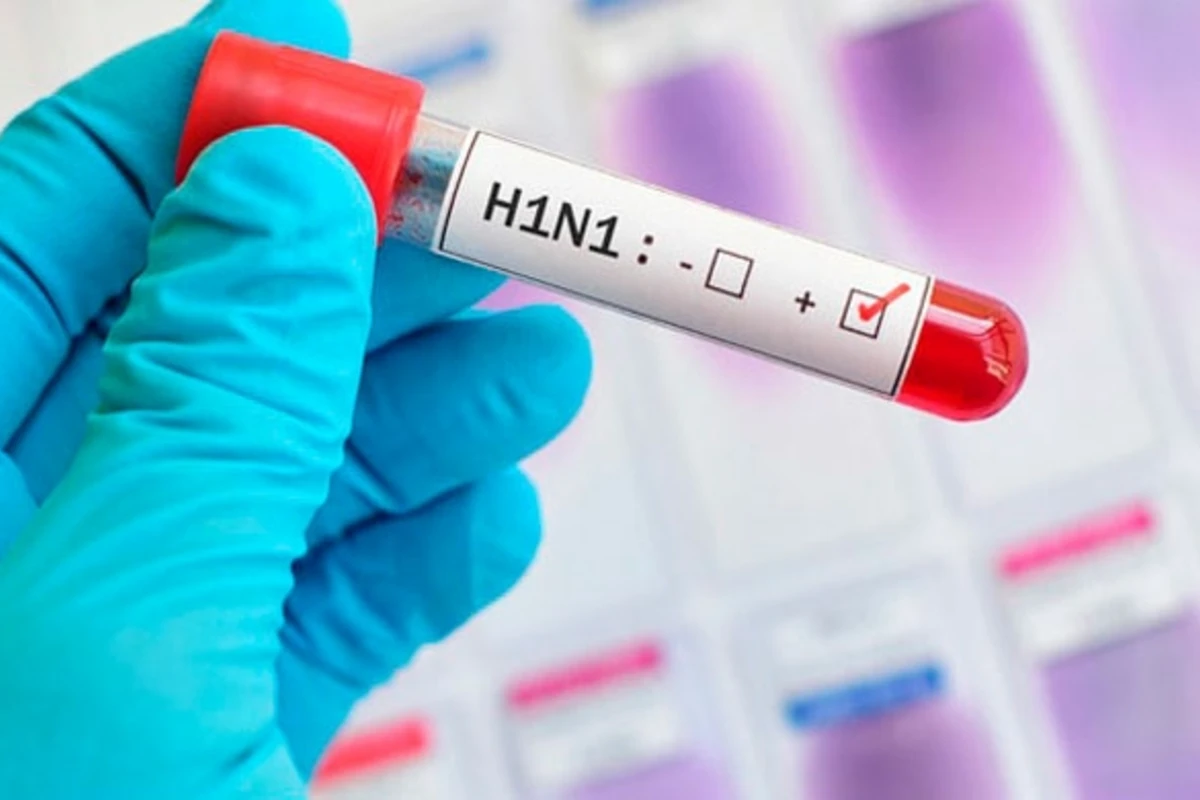 ÜST TƏCİLİ açıqlama verdi - Azərbaycanda H1N1 virusunun olması təsdiqləndi (VİDEO) ÜST TƏCİLİ açıqlama verdi - Azərbaycanda H1N1 virusunun olması təsdiqləndi (VİDEO)