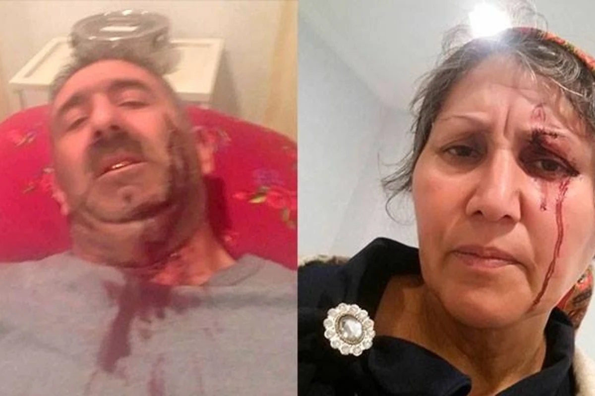 Qaçırılan qızın yaxınları oğlanın ata-anasını bıçaqladılar - FOTO