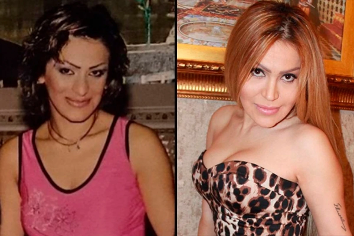Rəqsanənin plastik əməliyyatlardan əvvəlki görüntüsü üzə çıxdı - FOTO