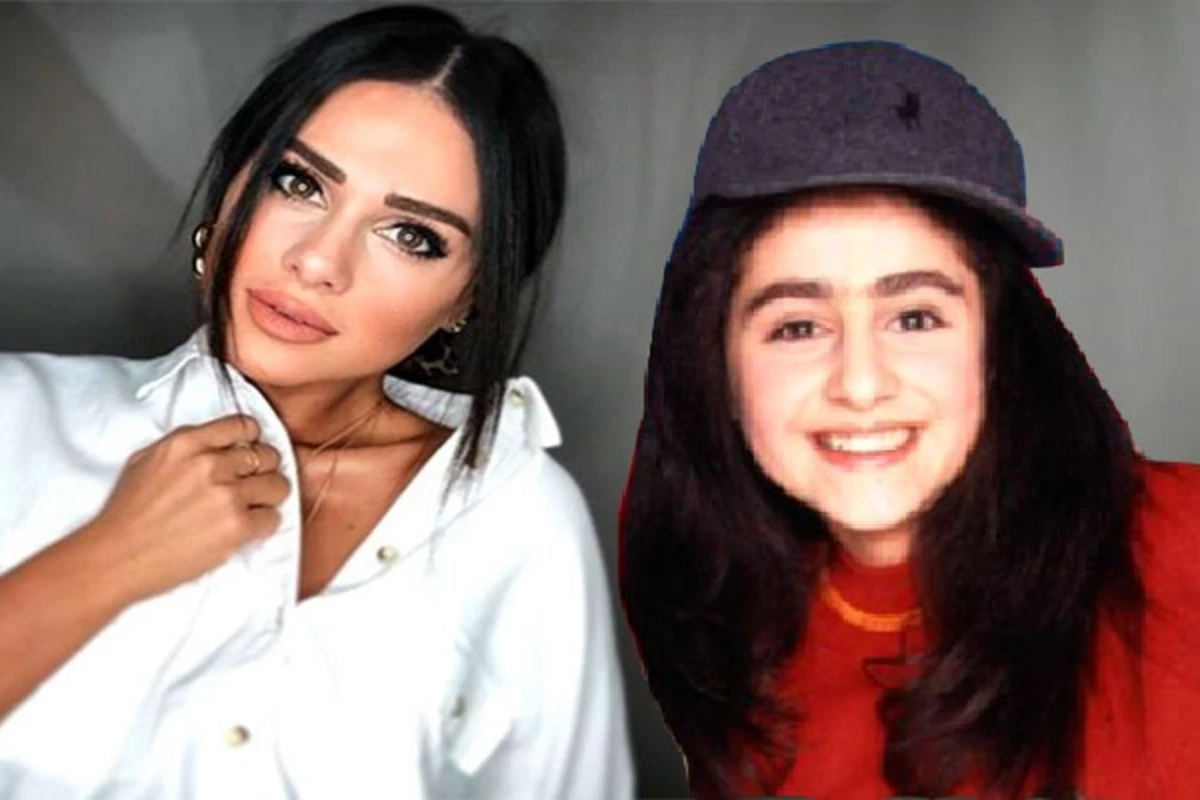 Qaşlarını aldırdı, dodağını şişirtdi - türk mediası Güneldən yazır... (FOTOLAR) Qaşlarını aldırdı, dodağını şişirtdi - türk mediası Güneldən yazır... (FOTOLAR)