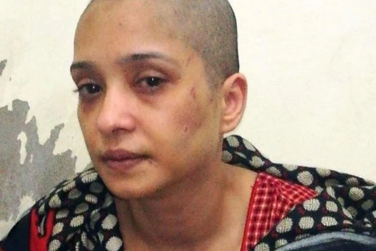 Муж избил жену и побрил налысо, когда она отказалась танцевать для его друзей - ФОТО