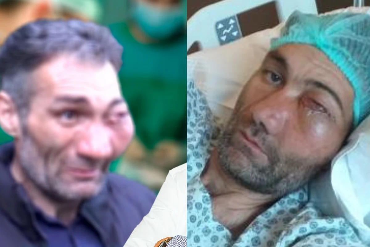 Üzü tanınmaz hala düşən fəhlə Türkiyəyə aparıldı