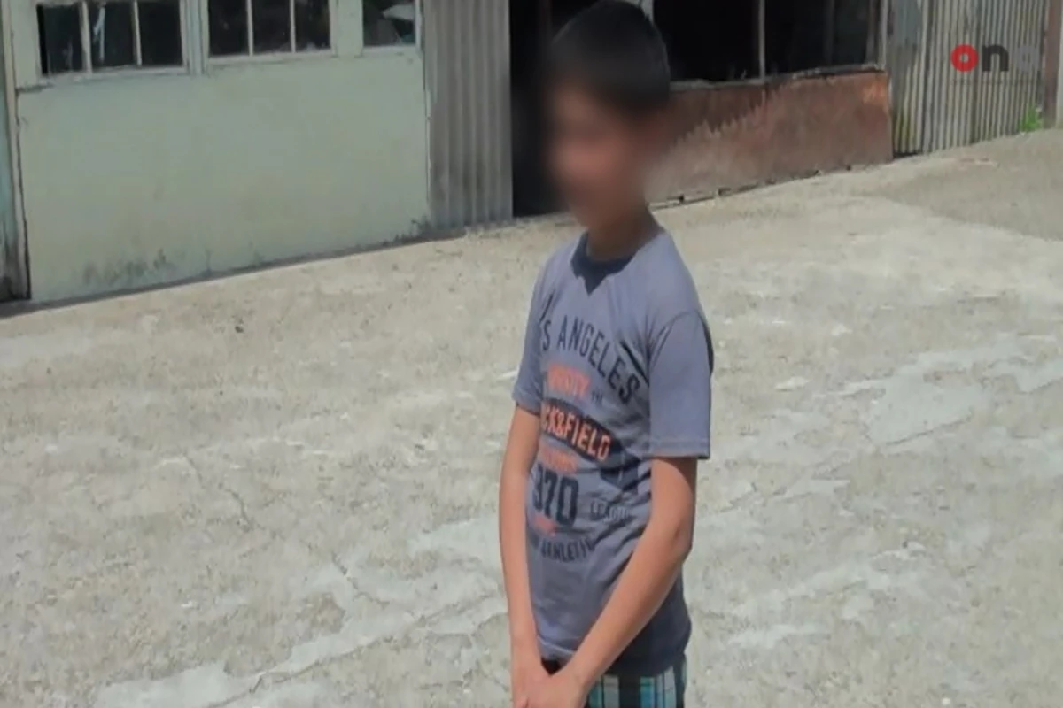 В Азербайджане бездомная собака укусила 11-летнего ребенка - ФОТО