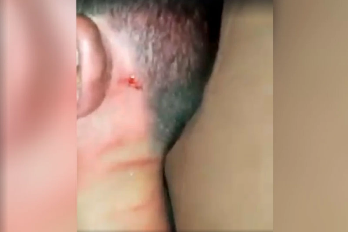 Azərbaycanda ata öz oğlunu vəhşicəsinə döydü - 18+ GÖRÜNTÜLƏR - VİDEO Azərbaycanda ata öz oğlunu vəhşicəsinə döydü - 18+ GÖRÜNTÜLƏR - VİDEO