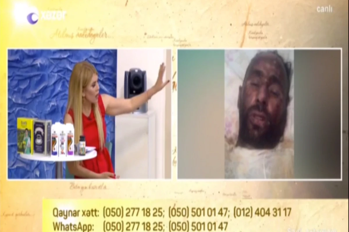 Üstünə benzin tökülərək yandırılan 2 uşaq atasının ölmədən öncə danışdıqları - VİDEO