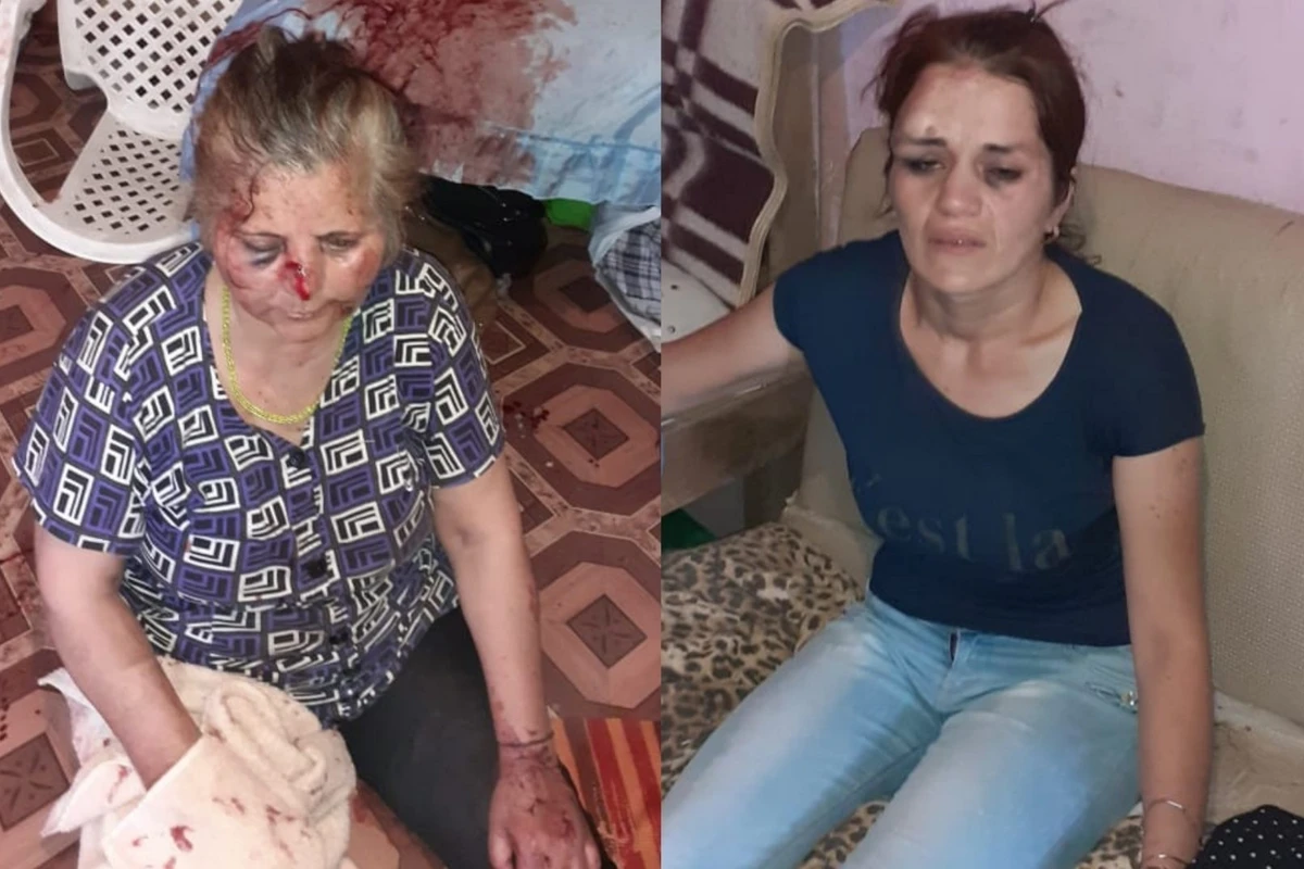 Bakıda qaynanasını döyən kürəkən saxlanılıb Bakıda qaynanasını döyən kürəkən saxlanılıb