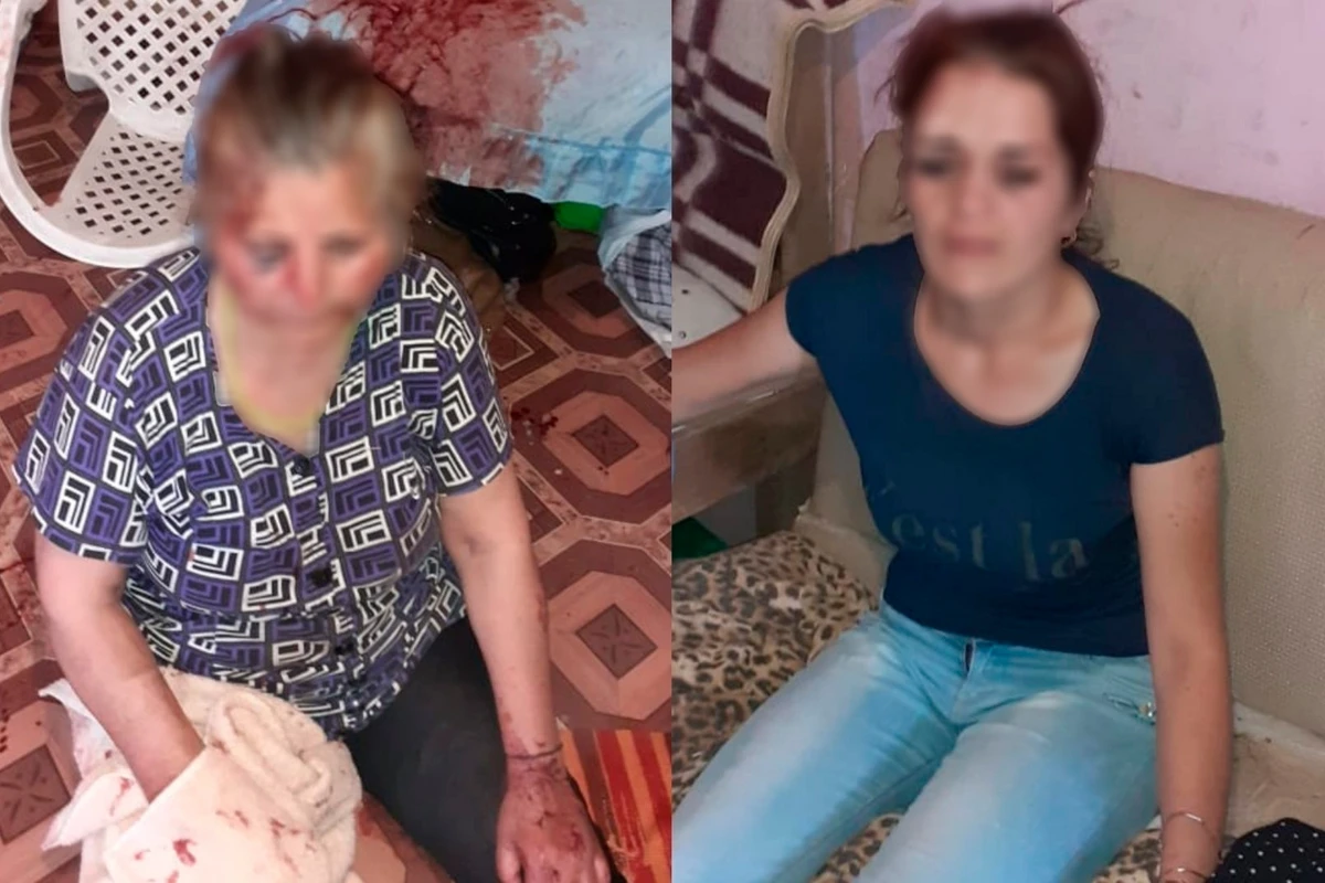 Bakıda qaynanasını döyən kürəkəndən YENİ XƏBƏR Bakıda qaynanasını döyən kürəkəndən YENİ XƏBƏR