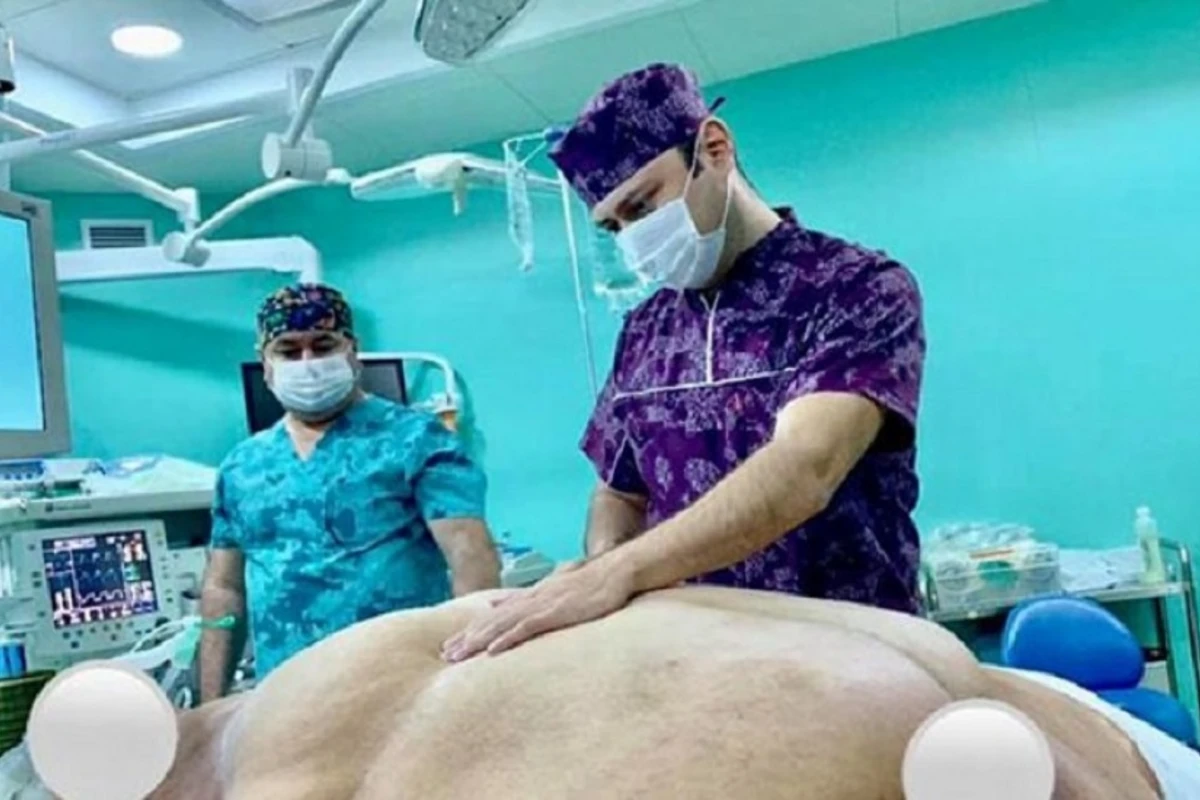 В Баку 256-килограммовой женщине сделали сложную операцию - ФОТО