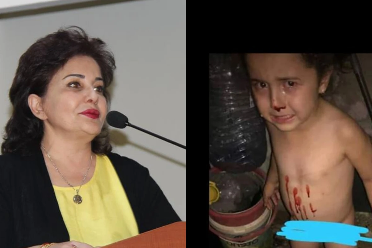 Azərbaycanda bir ailənin iki körpəsinin burnundan qəfildən qan açılır və... - FOTO