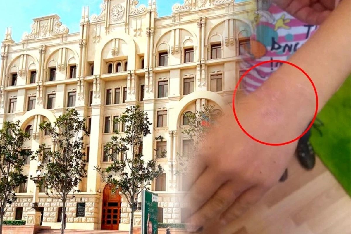 Anası tərəfindən azyaşlının döyülməsi ilə bağlı RƏSMİ AÇIQLAMA