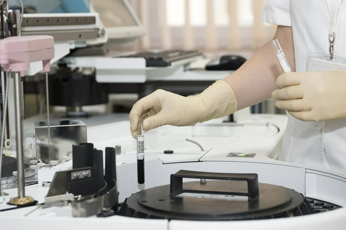 В Грузии зафиксирована первая смерть от опасной лихорадки