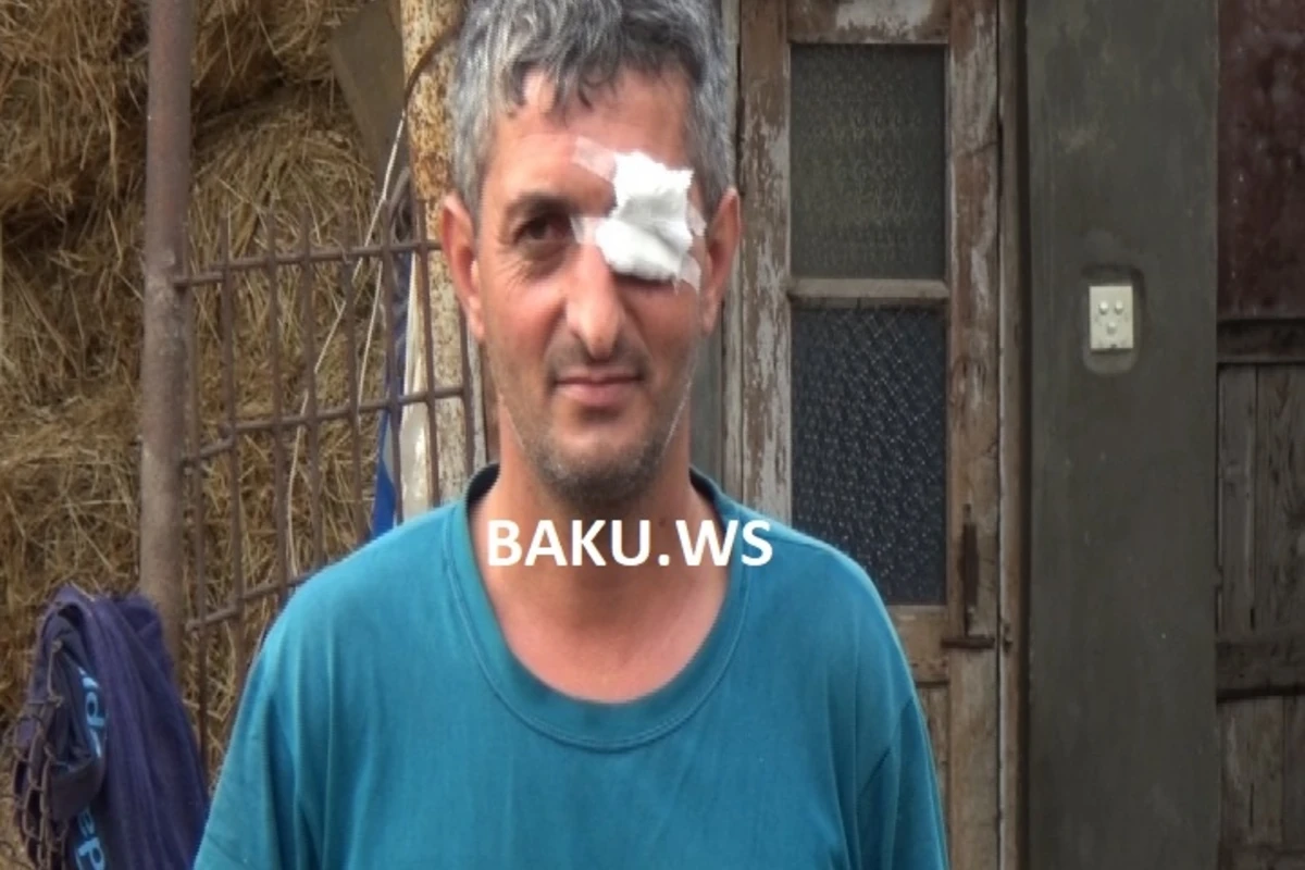 Azərbaycanda inək kişinin gözünü çıxardı - VİDEO
