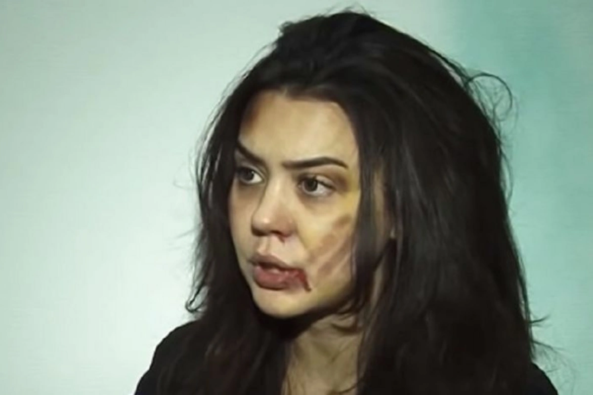 Həyat yoldaşı tərəfindən döyülən Oksana: Qaçıb rəfiqəmin evinə sığındım - VİDEO