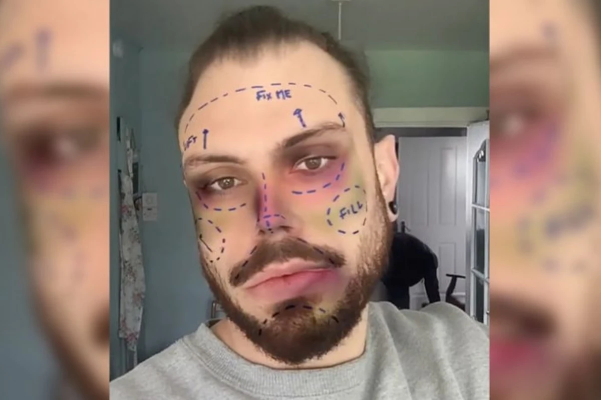 Instagram удалит все фильтры пластической хирургии