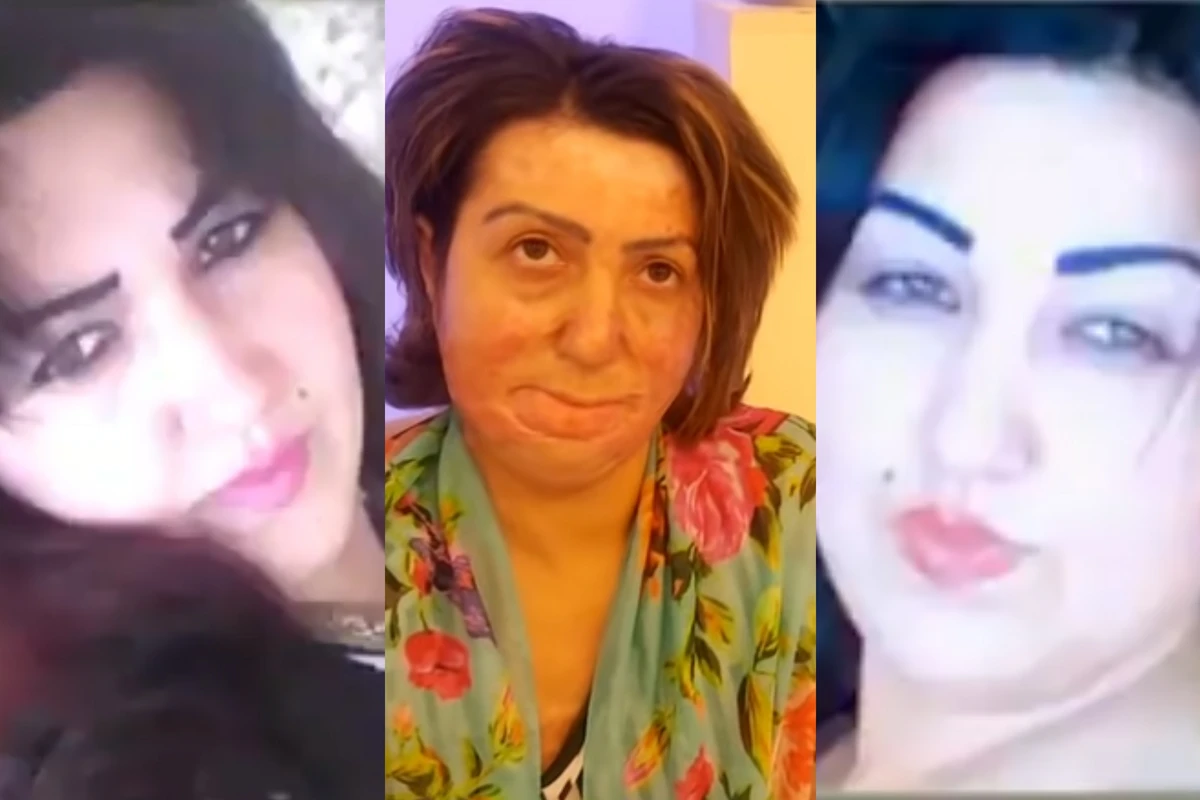 Azərbaycanda DƏHŞƏT: Pula görə sevgilisinin üstünə benzin töküb yandırdı - VİDEO