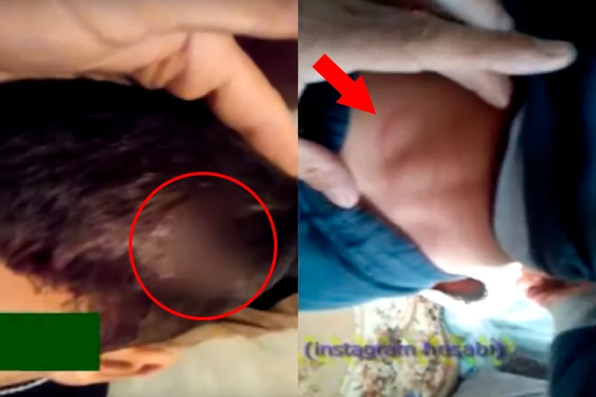 Azərbaycanda ana uşağını vəhşicəsinə döyüb qanını tökdü - ŞOK VİDEO Azərbaycanda ana uşağını vəhşicəsinə döyüb qanını tökdü - ŞOK VİDEO