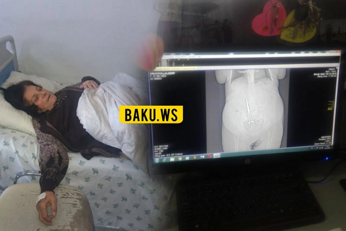 Gəncədə xəstənin qarnında qayçı unudan həkimlər cəzalandırıldılar - RƏSMİ