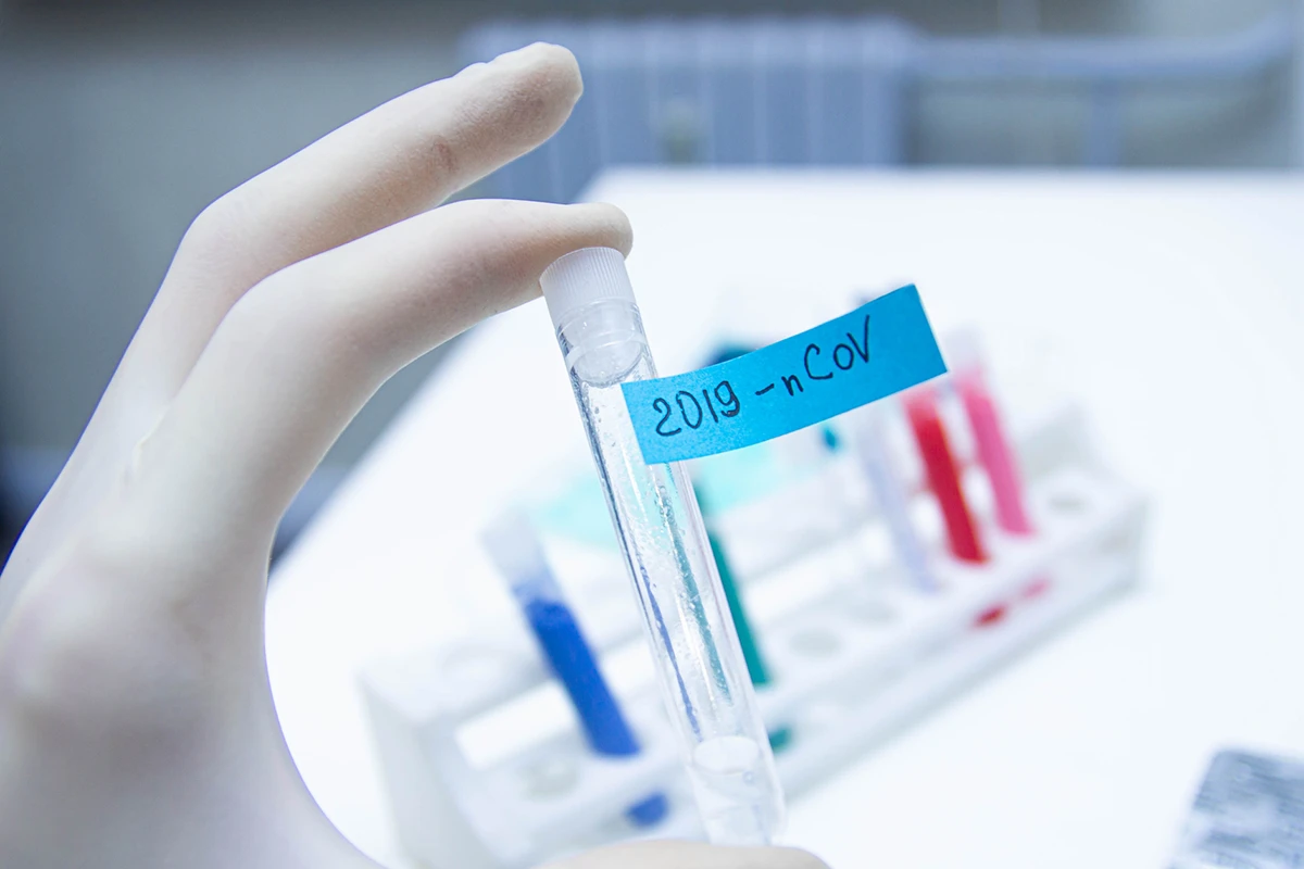 AMEA koronavirus sözünün düzgün tələffüzünü müəyyənləşdirib