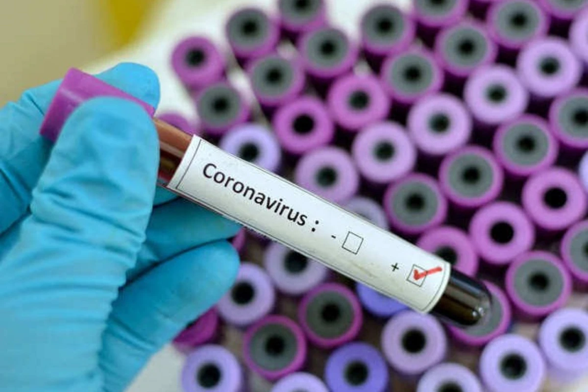 Koronavirusun nə vaxtadək yayılacağı açıqlandı