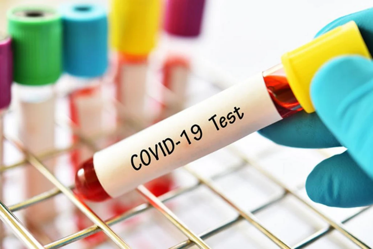 XƏBƏRDARLIQ - Azərbaycanda koronavirusa görə epidemioloji vəziyyət gərgindir - VİDEO XƏBƏRDARLIQ - Azərbaycanda koronavirusa görə epidemioloji vəziyyət gərgindir - VİDEO