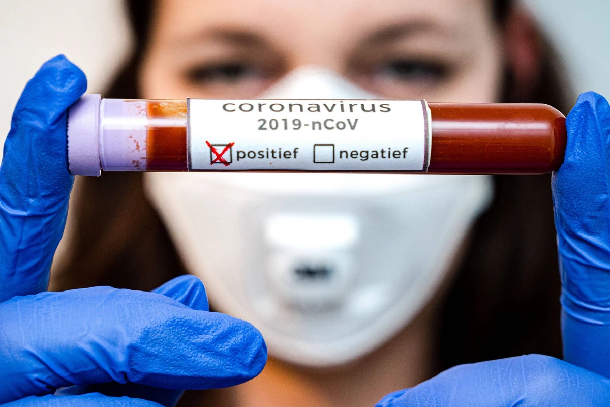 Naxçıvanda 71 nəfərdə koronavirus aşkarlanıb