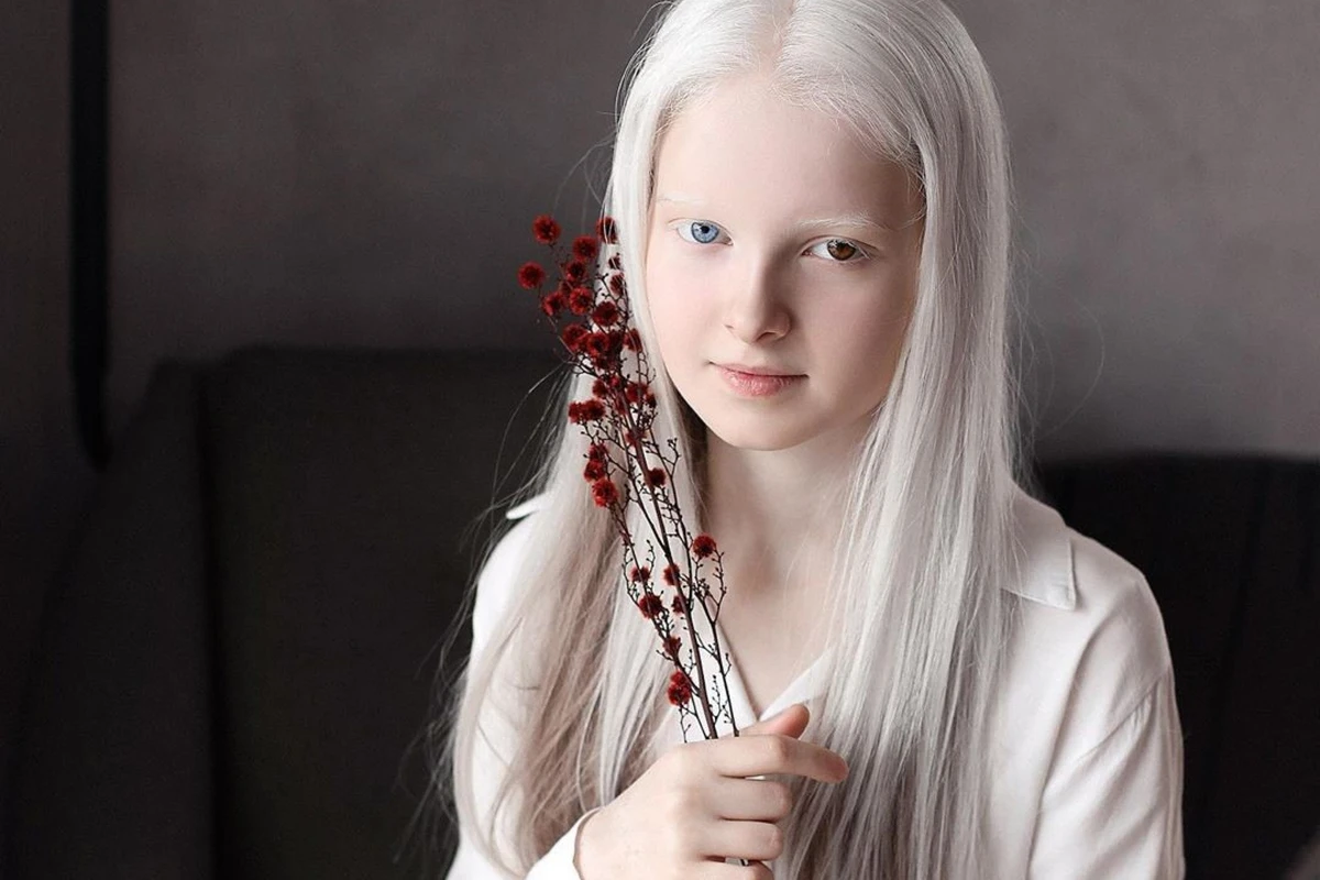 11-летняя девочка из Чечни удивила своей необычной красотой - ФОТО 11-летняя девочка из Чечни удивила своей необычной красотой - ФОТО
