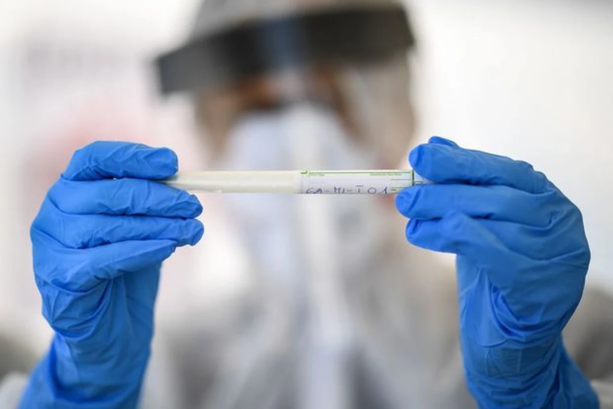 Azərbaycanda nazirliyin 15 əməkdaşında koronavirus aşkarlandı - RƏSMİ AÇIQLAMA