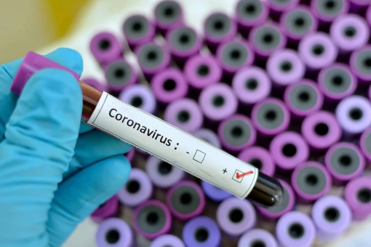 Ermənistanda 189 nəfərdə koronavirus aşkarlanıb, 5 nəfər ölüb