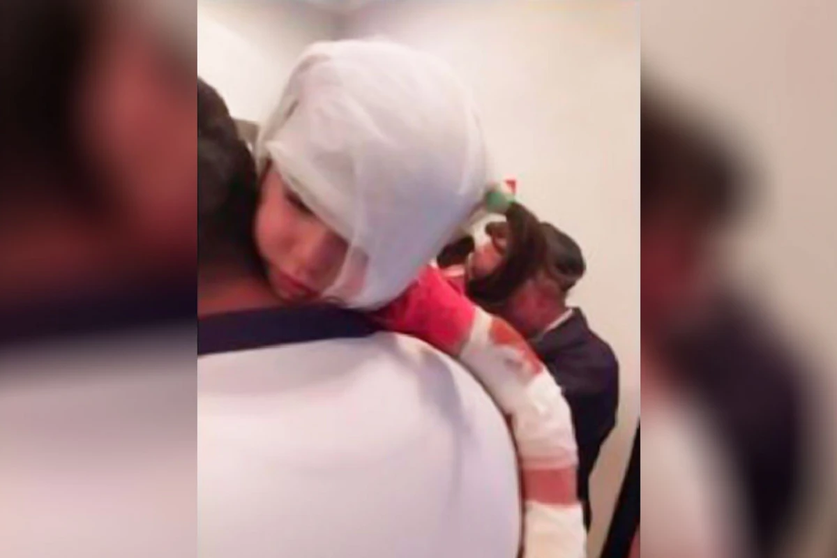 В Азербайджане бездомная собака покусала 3 человек, включая 6-летнего мальчика
