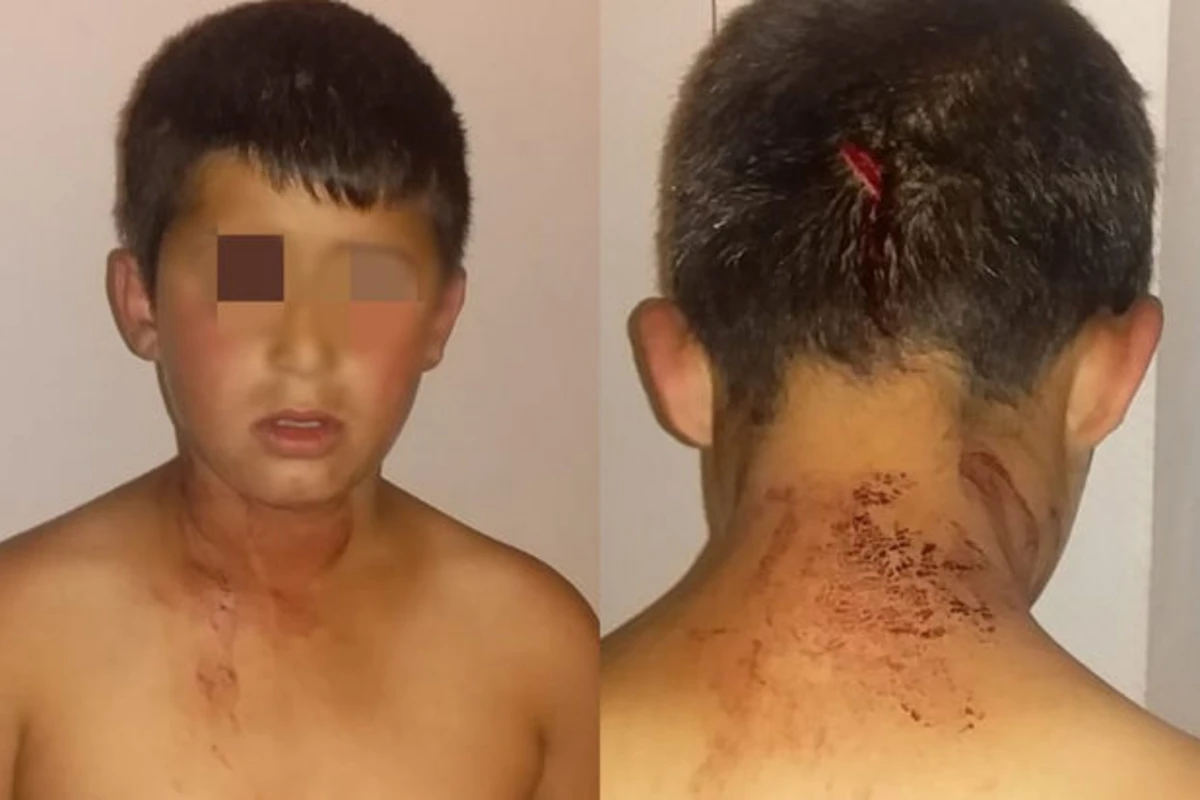 Bakıda başından bıçaqlanan uşaqla bağlı RƏSMİ AÇIQLAMA Bakıda başından bıçaqlanan uşaqla bağlı RƏSMİ AÇIQLAMA