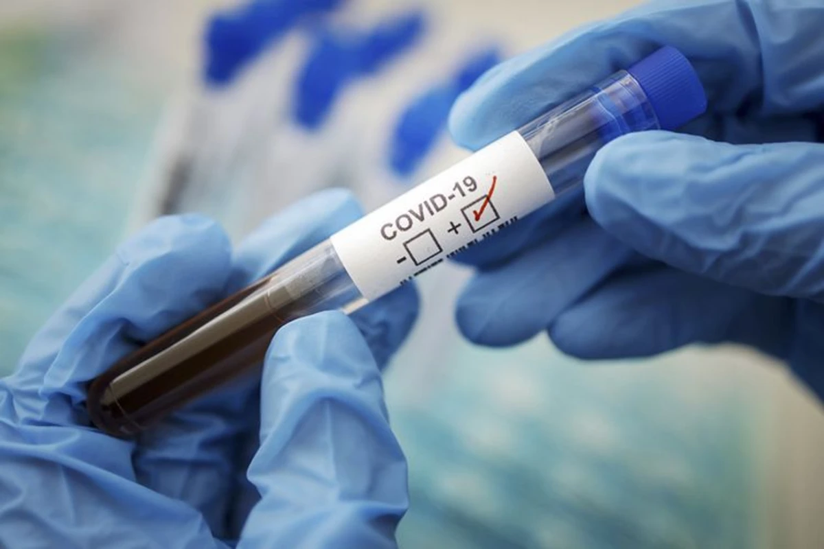 Azərbaycanda daha 230 nəfərdə koronavirus aşkarlandı Azərbaycanda daha 230 nəfərdə koronavirus aşkarlandı