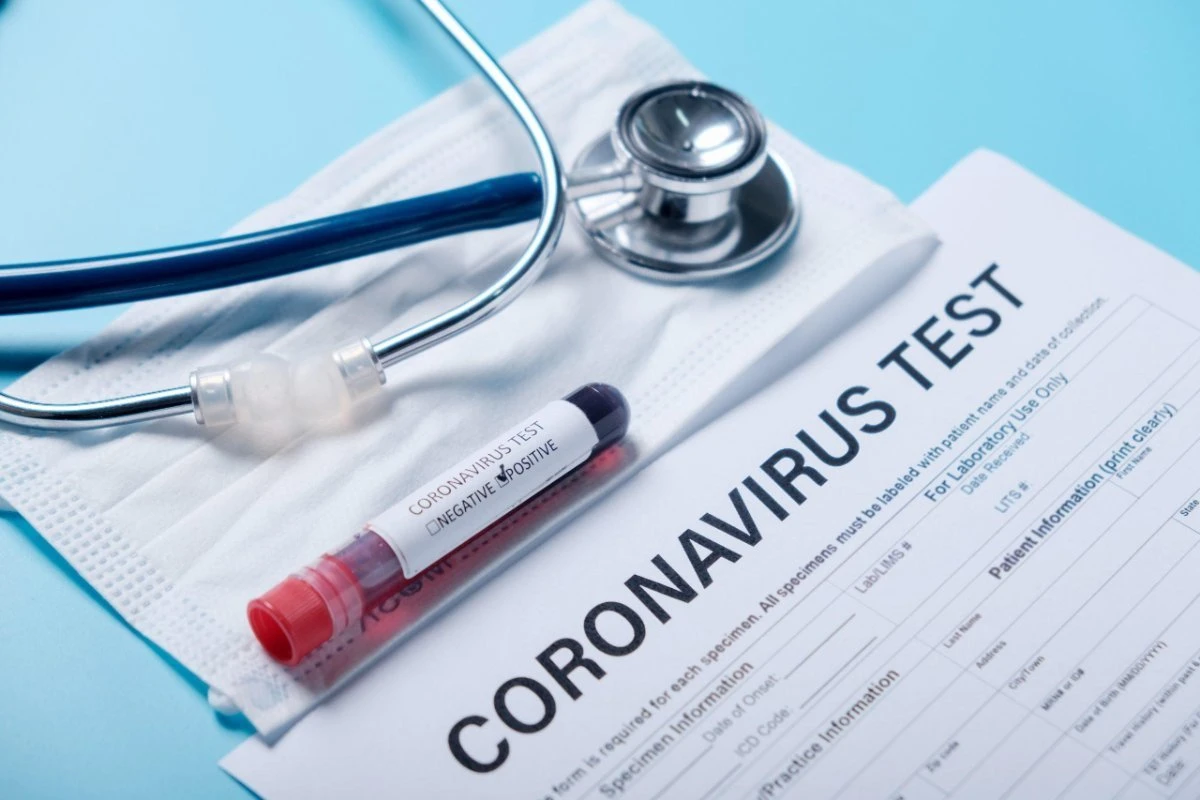 Milli Məclisin əməkdaşları koronavirus testindən keçirilir