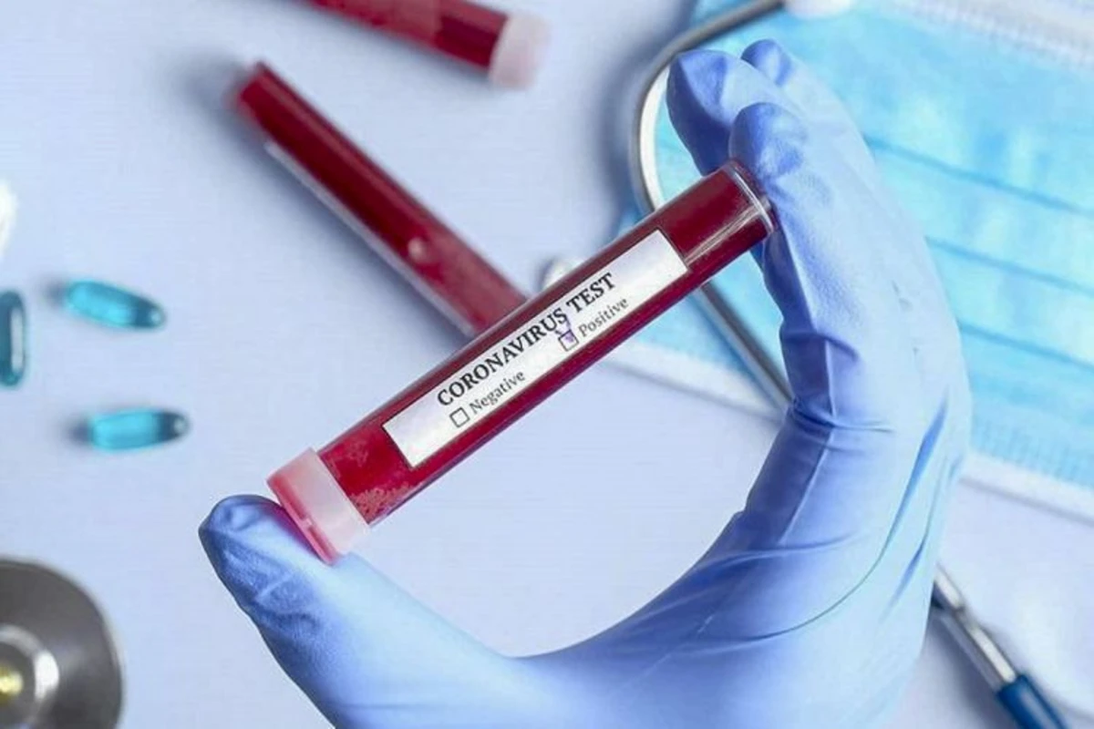 Azərbaycanda aparılmış koronavirus testlərinin sayı 310 minə yaxınlaşır