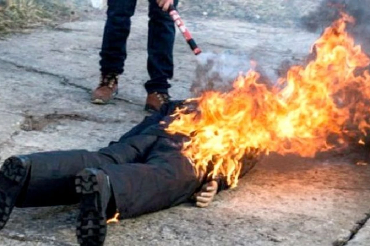 Bakıda 35 yaşlı kişinin özünü yandırması ilə bağlı cinayət işi başlanıb