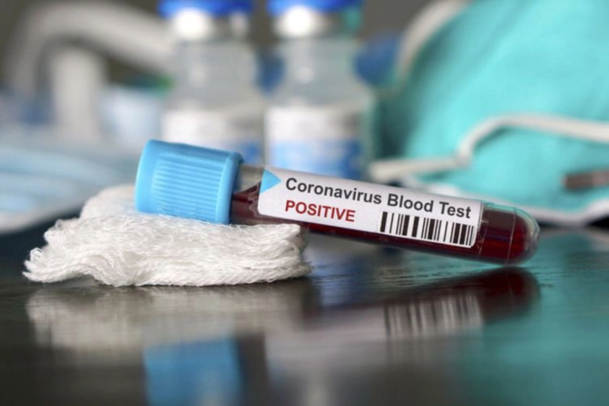 Azərbaycanda indiyədək 328 385 koronavirus testi aparılıb