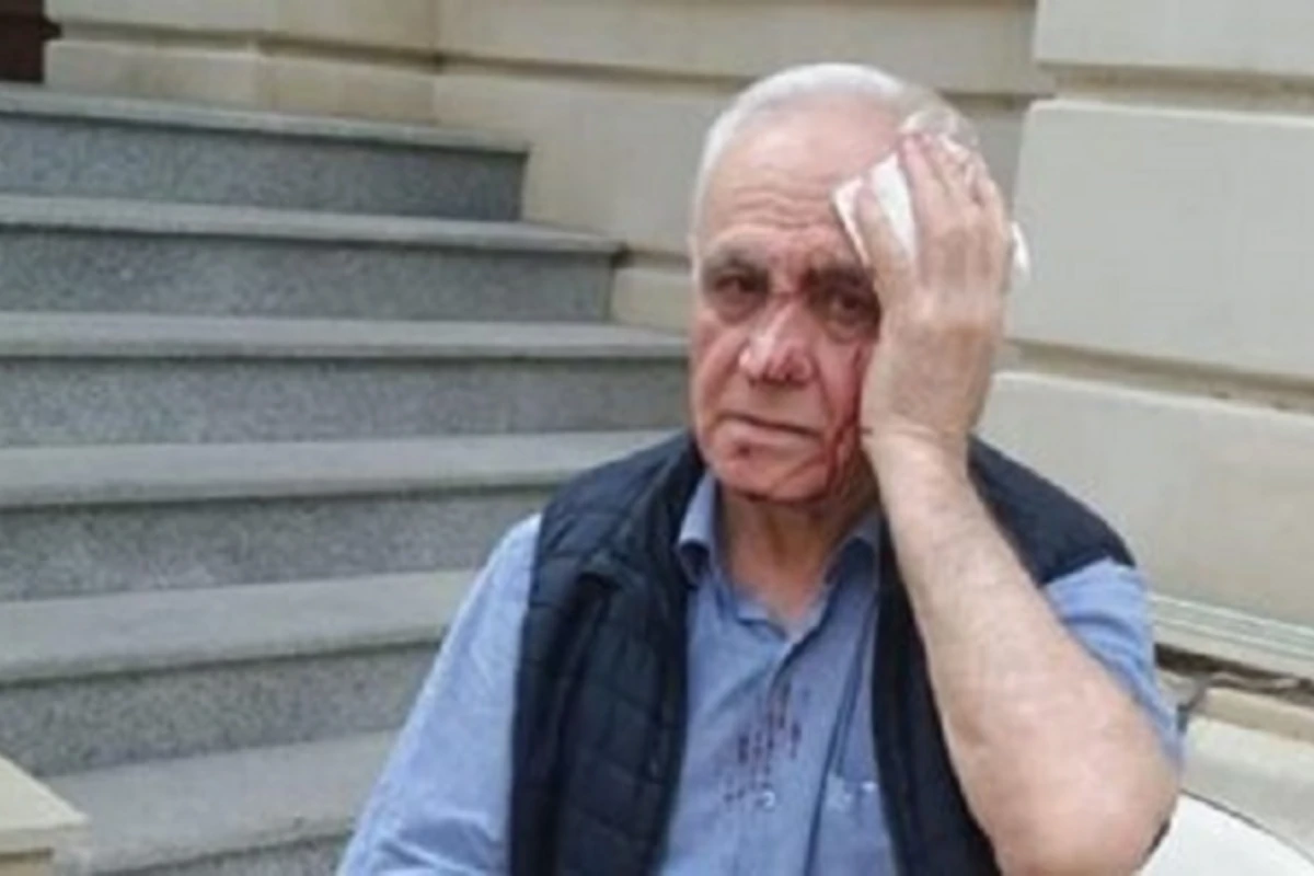 Rəhim Qazıyevin xəsarət alması ilə bağlı cinayət işi başlanıb, şübhəli şəxs var